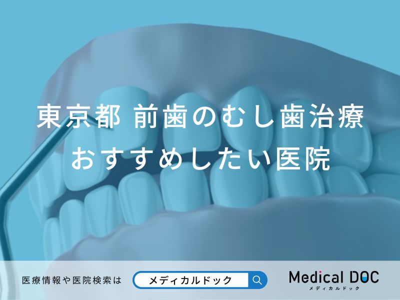 東京都 前歯の虫歯治療