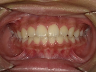 チャイルドしかハウス