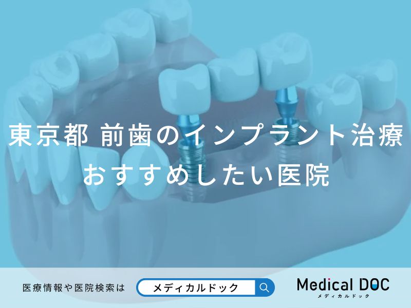 東京都 前歯のインプラント治療