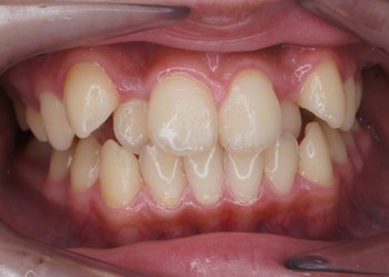 登戸クローバー歯科・矯正歯科