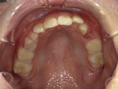 チャイルドしかハウス