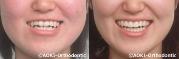あおき矯正歯科