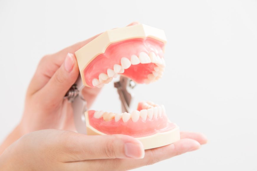 出っ歯について