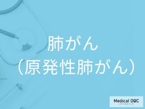 肺がん（原発性肺がん）