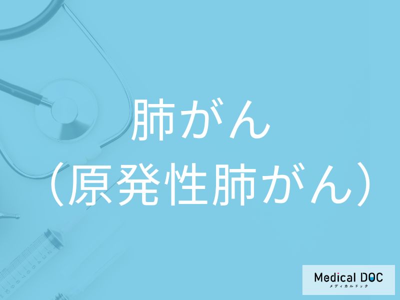 肺がん（原発性肺がん）