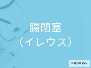 腸閉塞（イレウス）