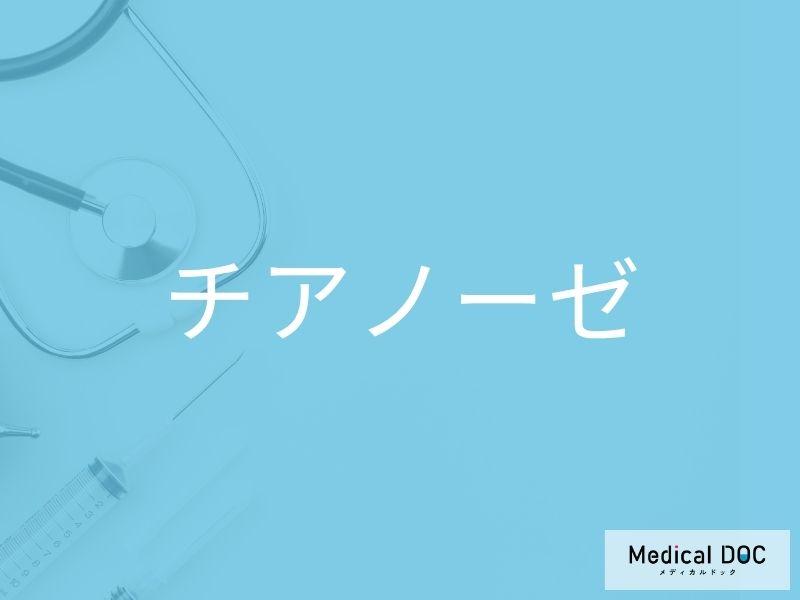 チアノーゼ