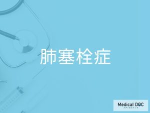 肺塞栓症
