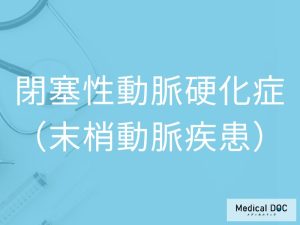 閉塞性動脈硬化症（末梢動脈疾患）