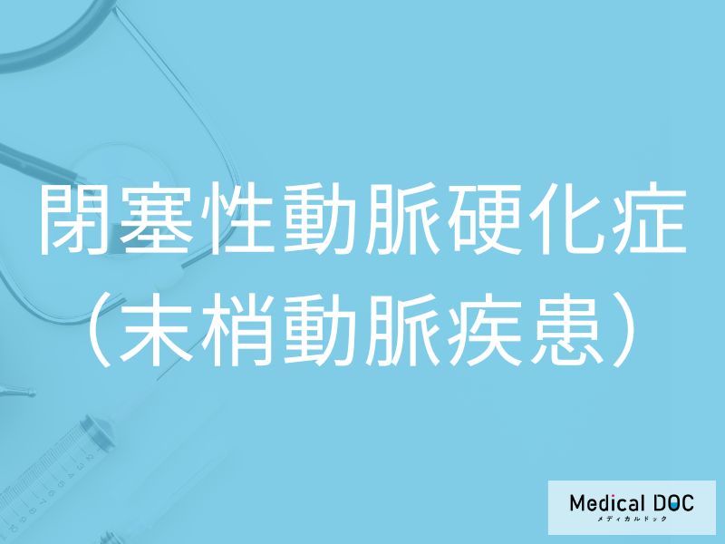 閉塞性動脈硬化症（末梢動脈疾患）