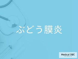 ぶどう膜炎