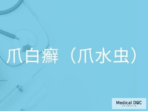 爪白癬（爪水虫）