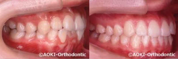 あおき矯正歯科