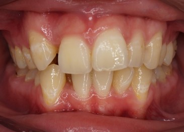 桜新町グリーン歯科・矯正歯科