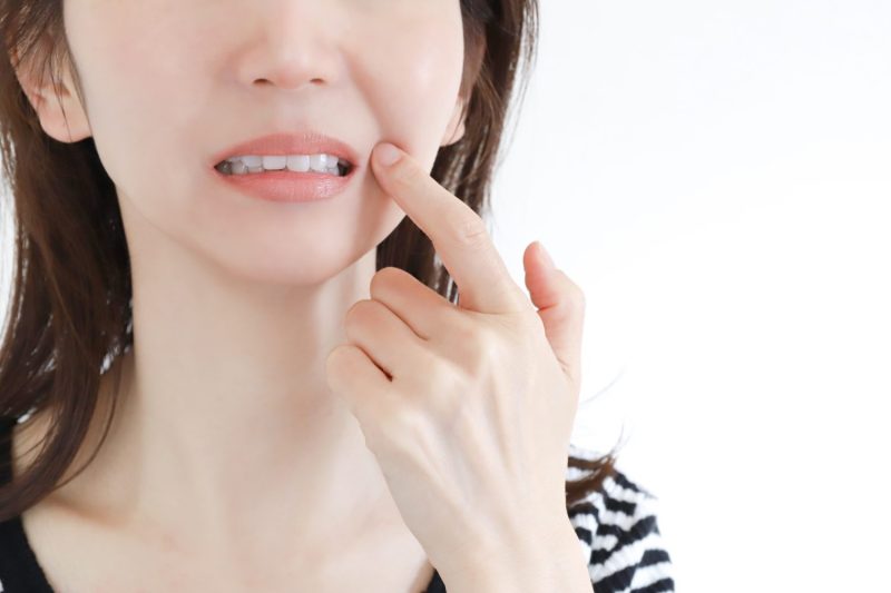 インビザラインは口内炎ができやすい？原因や対処法、予防法を解説