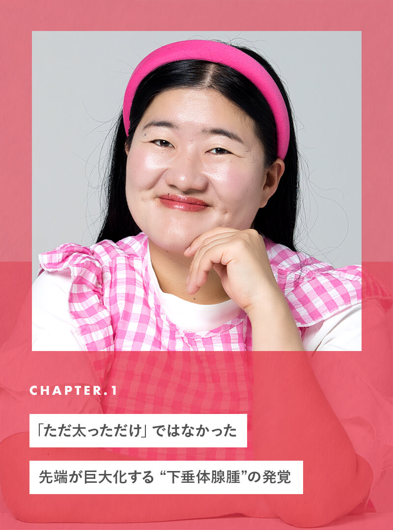 chapter01 「ただ太っただけ」ではなかった。先端が巨大化する“下垂体腺腫”の発覚