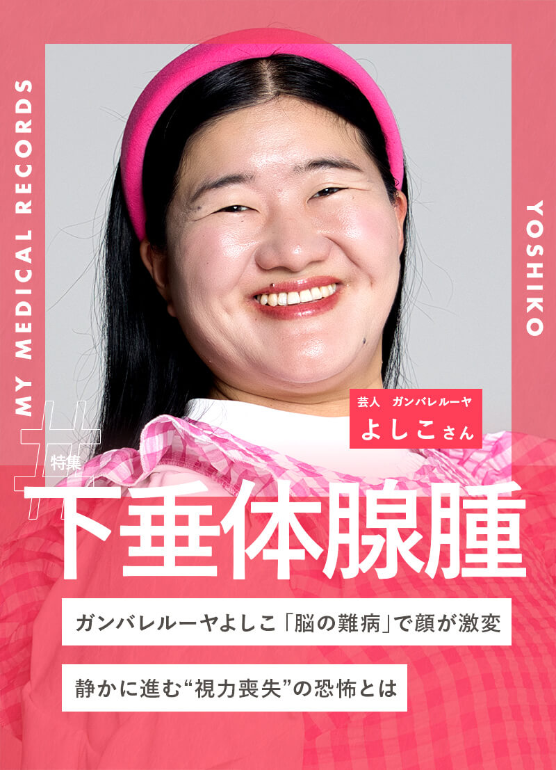 ガンバレルーヤよしこ「脳の難病」で顔が激変。静かに進む“視力喪失”の恐怖とは