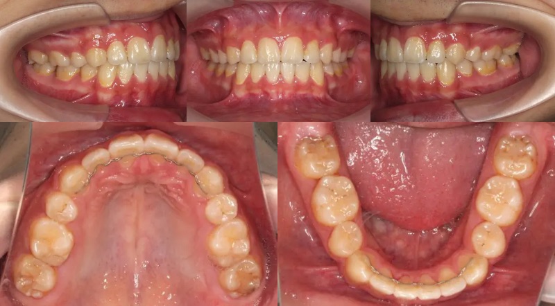 蒲田あさみ矯正歯科