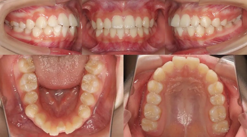 蒲田あさみ矯正歯科