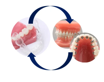 川崎市宮前区 矯正歯科 5