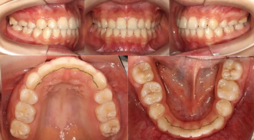 蒲田あさみ矯正歯科