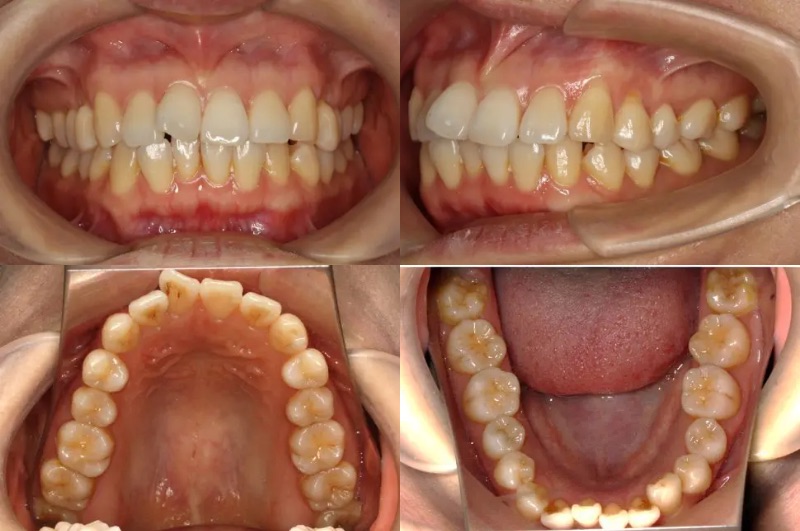 蒲田あさみ矯正歯科