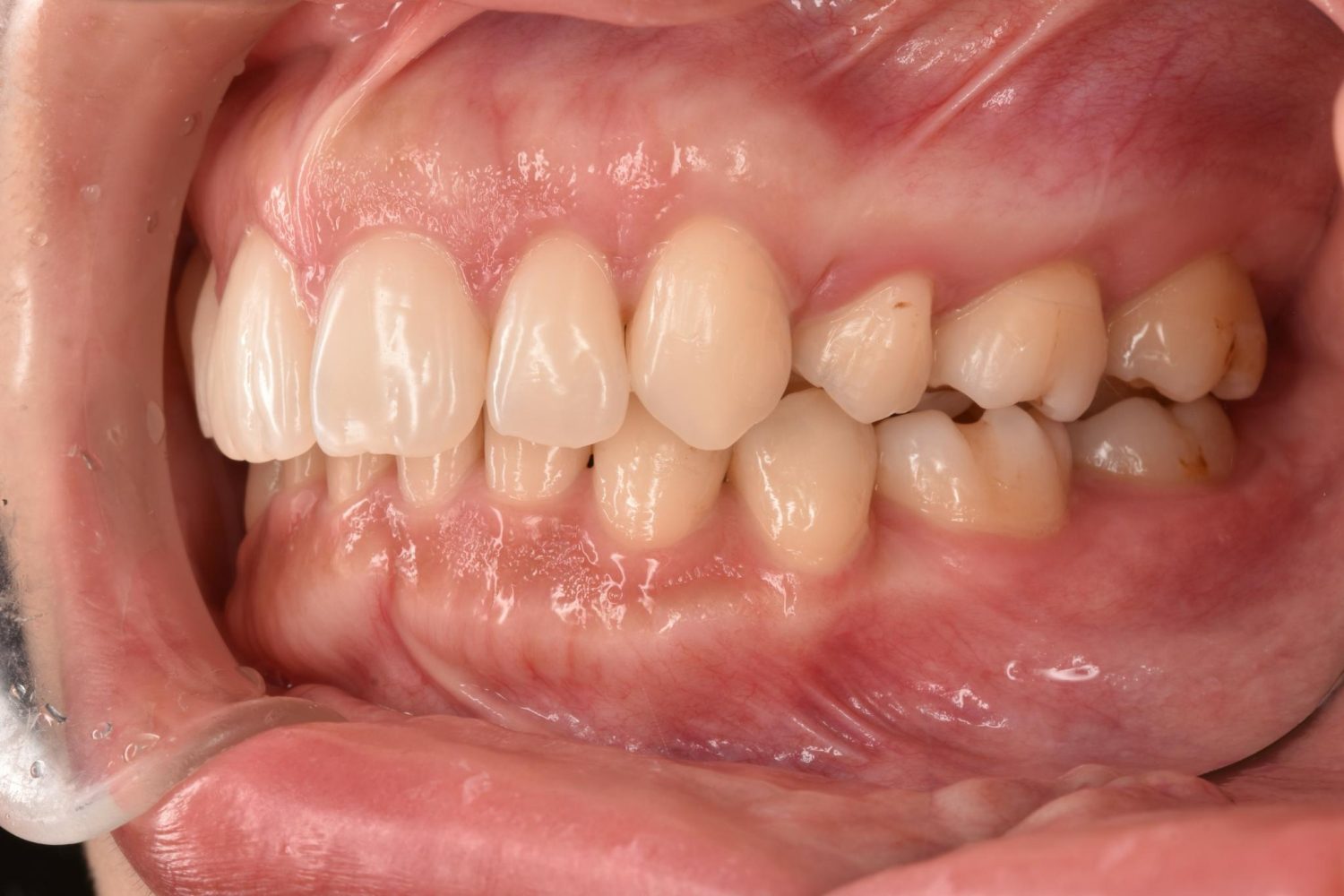 シャングリラデンタル横浜歯科矯正歯科