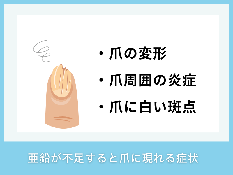亜鉛が不足すると爪にどんな症状が現れる？