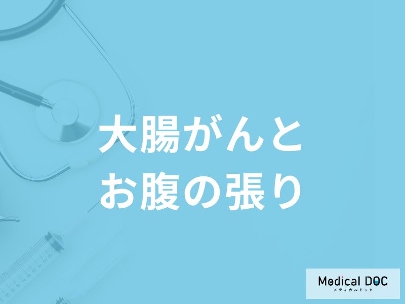 「大腸がん」を発症すると「お腹にどんな張り」を感じる？張りを感じる場所も医師が解説！