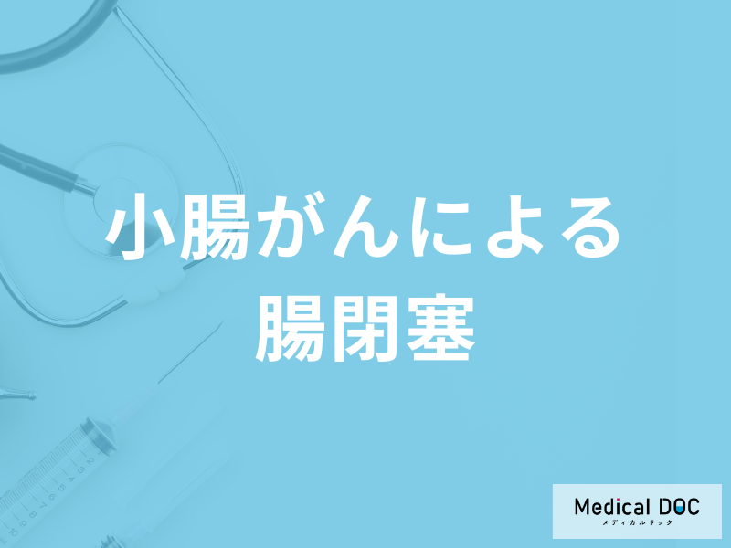 「小腸がん」が進むと「腸閉塞」になるのか？腸閉塞の症状について医師が解説！