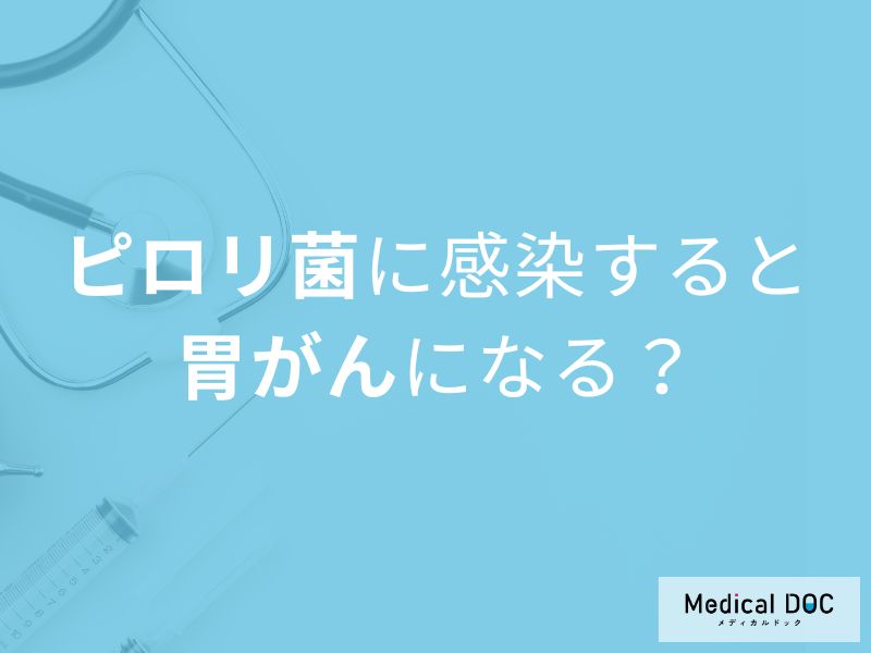 「ピロリ菌と胃がん」の関係はご存知ですか？胃がんを発症する確率も解説！【医師監修】