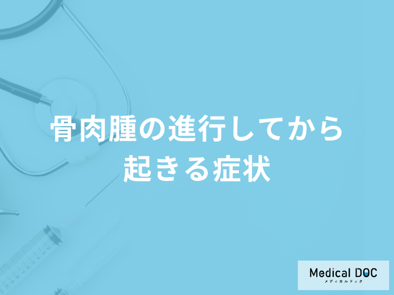「骨肉腫が進行するとどんな症状が現れる」かご存知ですか?医師が徹底解説!