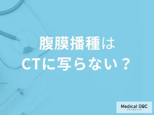 「腹膜播種はCT検査」では写らない？その理由と検査方法を医師が解説！