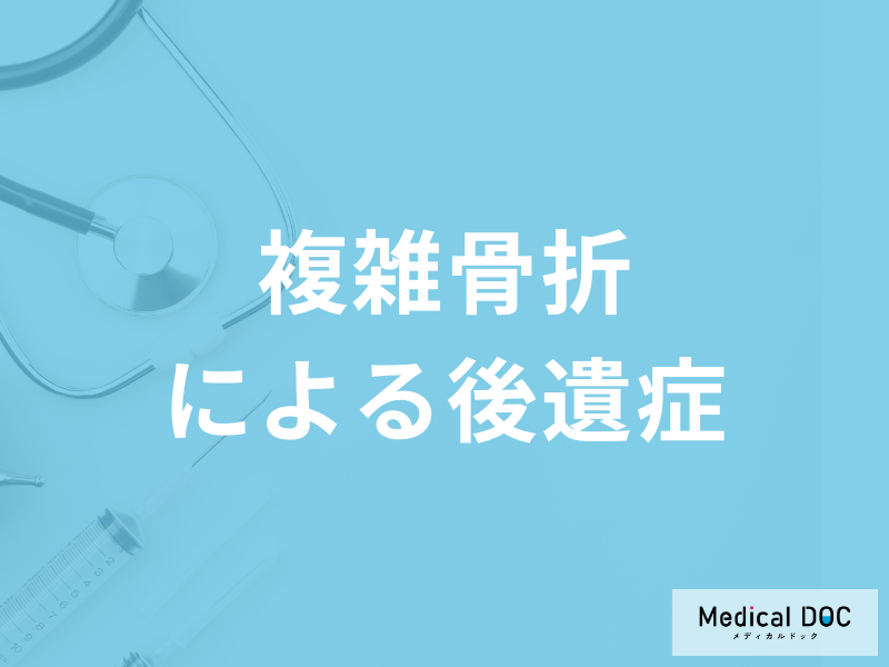 「複雑骨折による後遺症」はご存じですか？予防法も医師が解説！