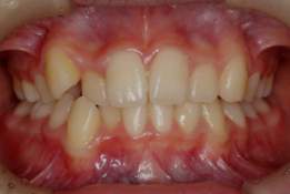 蒲田あさみ矯正歯科