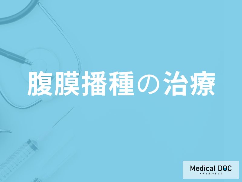 「腹膜播種の先進治療」はご存じですか？放置した際に現れる症状も医師が解説！