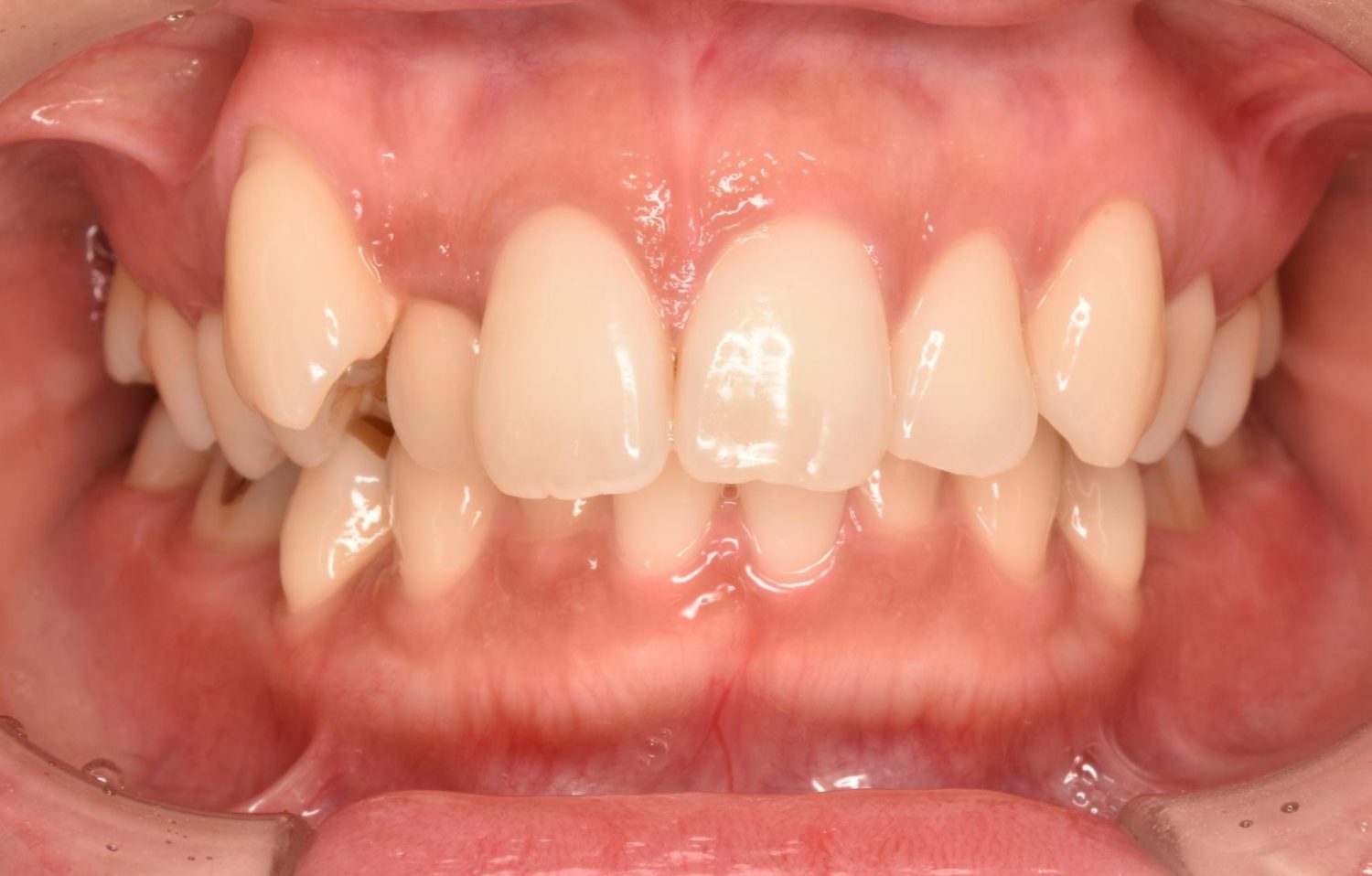 シャングリラデンタル横浜歯科矯正歯科