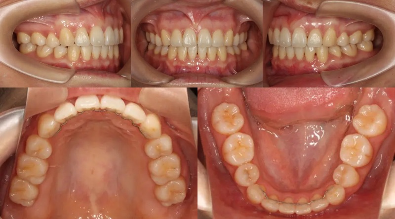 蒲田あさみ矯正歯科