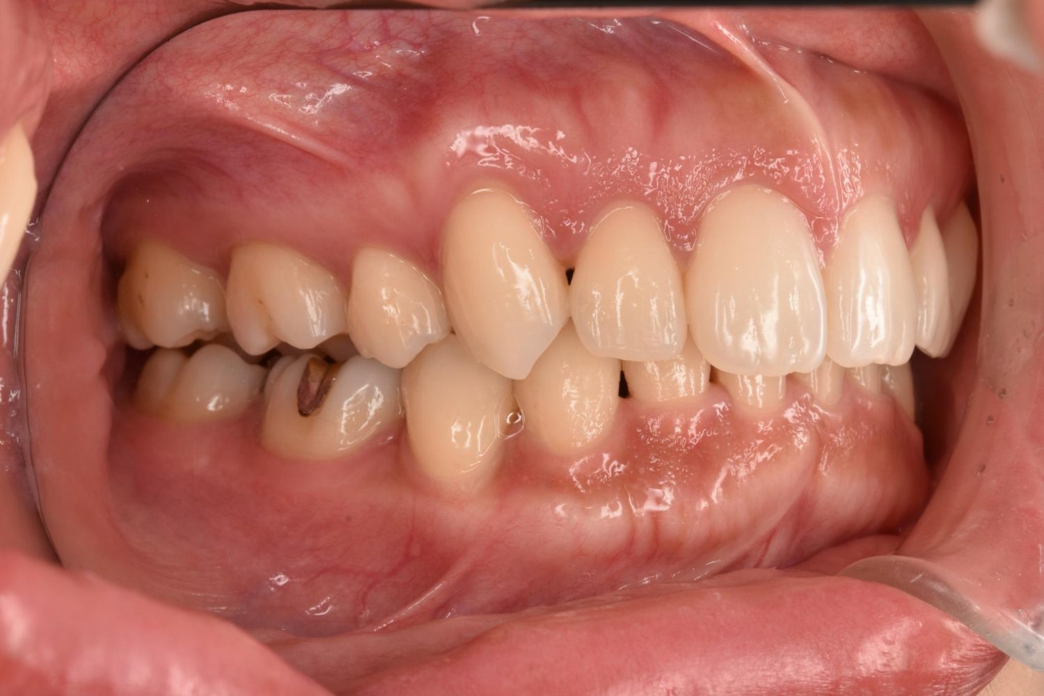 シャングリラデンタル横浜歯科矯正歯科