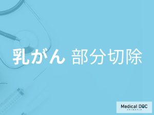 「乳がんの部分切除」はご存じですか？身体の変化も医師が解説！