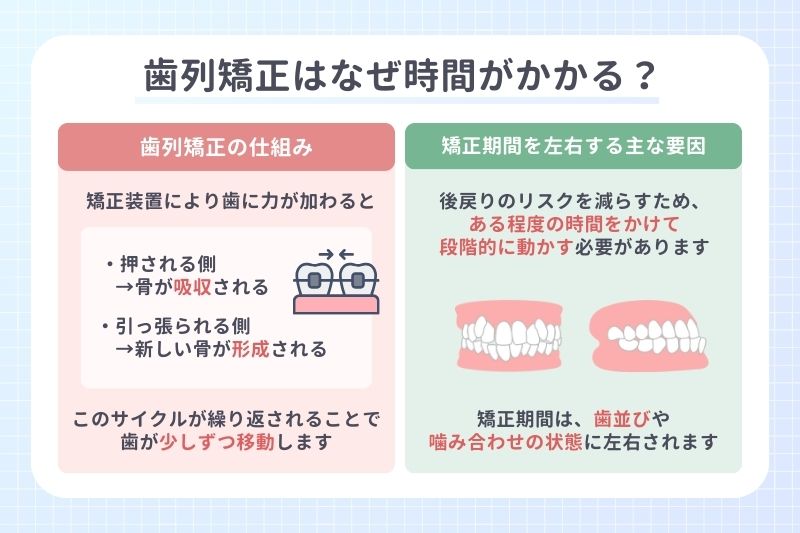 歯列矯正はなぜ時間がかかる？