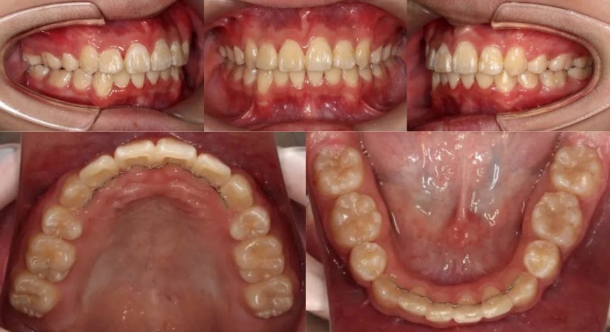 蒲田あさみ矯正歯科