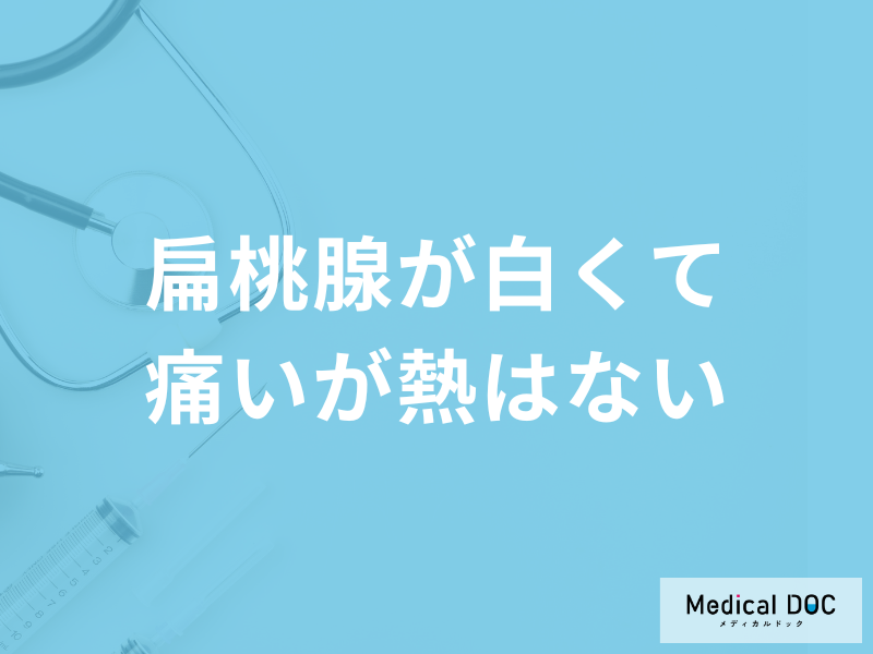 「扁桃腺が白くて痛いが熱はない」のはなぜ？考えられる病気や対処法を医師が解説！