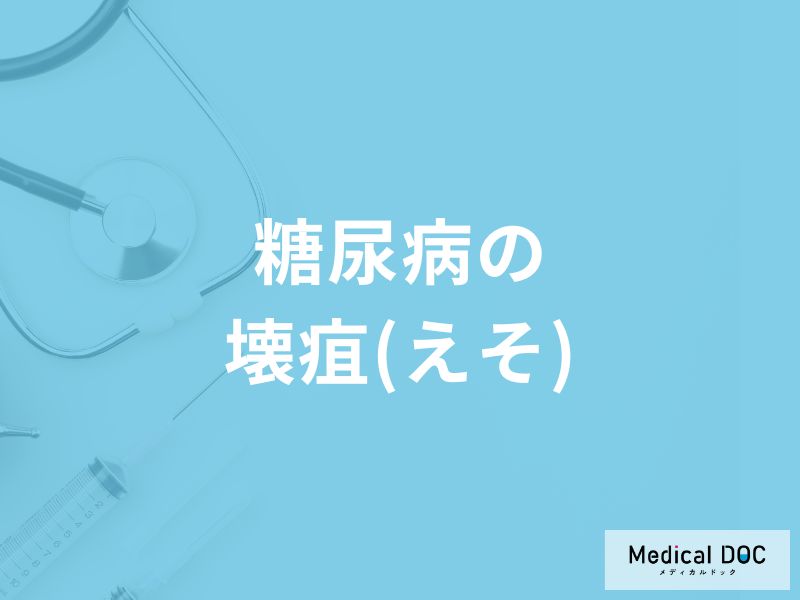 「糖尿病の壊疽（皮膚障害）」になるとどんな症状が現れる？壊疽の初期症状も解説！