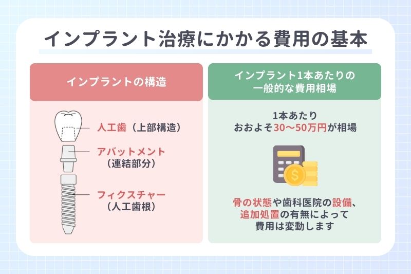 インプラント治療にかかる費用の基本