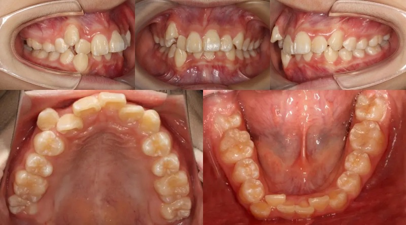 蒲田あさみ矯正歯科