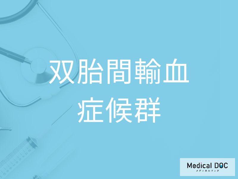 双胎間輸血症候群