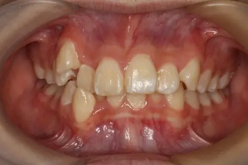 蒲田あさみ矯正歯科