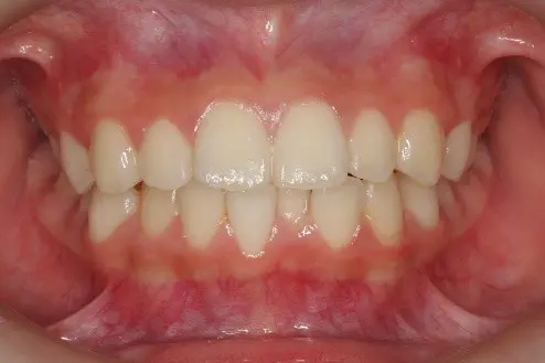 蒲田あさみ矯正歯科