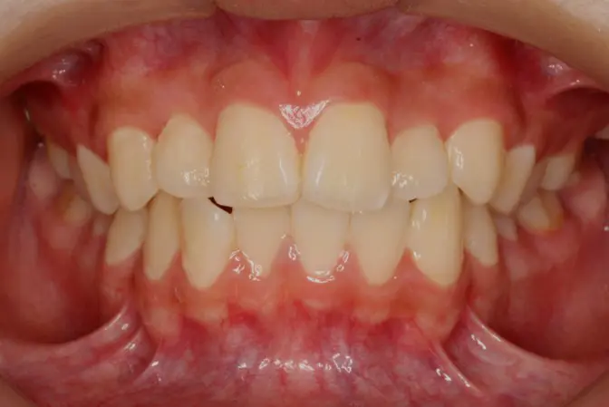 蒲田あさみ矯正歯科